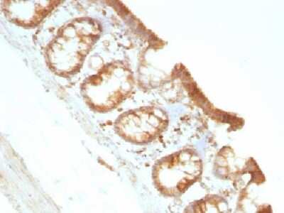 Immunohistochemistry-Paraffin: Moesin Antibody (MSN/491) - Azide and BSA Free [NBP2-34685]