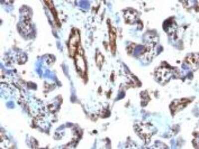 Immunohistochemistry-Paraffin: Moesin Antibody (MSN/491) [NBP2-32875]