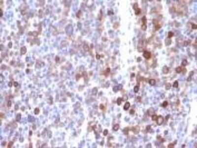 Immunohistochemistry-Paraffin: Moesin Antibody (MSN/491) [NBP2-32875]
