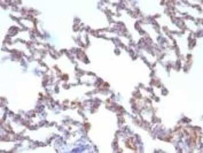 Immunohistochemistry-Paraffin: Moesin Antibody (MSN/491) [NBP2-32875]