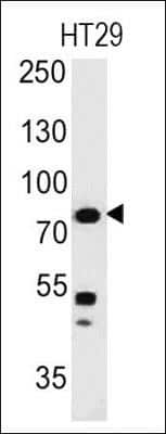 Western Blot: Moesin Antibody (MSN/491) [NBP2-32875]