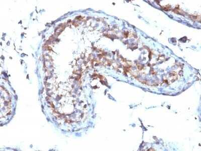 Immunohistochemistry-Paraffin: Moesin Antibody (MSN/492) - Azide and BSA Free [NBP2-47916]