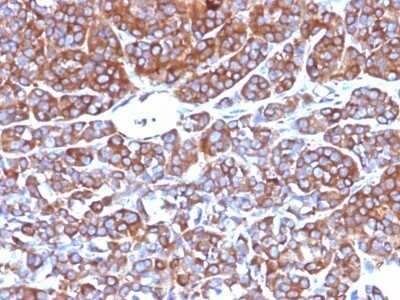 Immunohistochemistry-Paraffin: Moesin Antibody (MSN/492) - Azide and BSA Free [NBP2-47916]