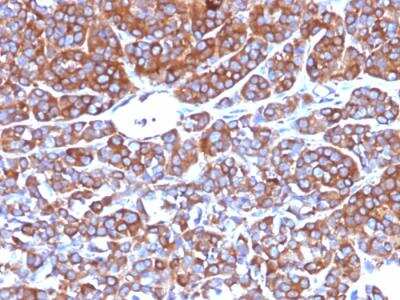 Immunohistochemistry-Paraffin: Moesin Antibody (MSN/492) - IHC-Prediluted [NBP2-48305]