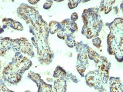Immunohistochemistry-Paraffin: Moesin Antibody (MSN/492) [NBP2-44579]