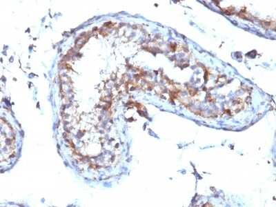 Immunohistochemistry-Paraffin: Moesin Antibody (MSN/492) [NBP2-44579]