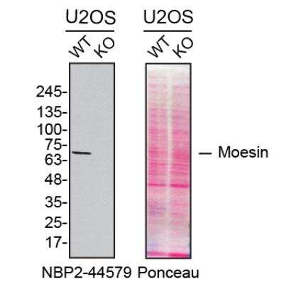 Knockout Validated: Moesin Antibody (MSN/492) [NBP2-44579]