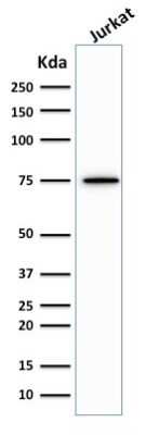 Western Blot: Moesin Antibody (MSN/492) [NBP2-44579]