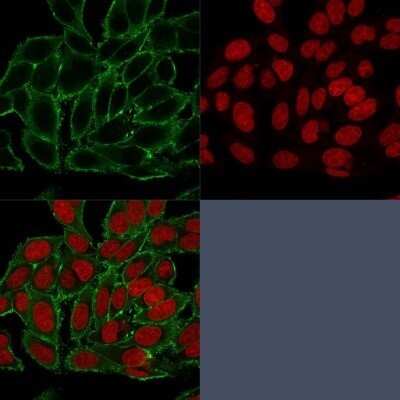 Immunocytochemistry/ Immunofluorescence: Moesin Antibody (MSN/493) - Azide and BSA Free [NBP2-47917]