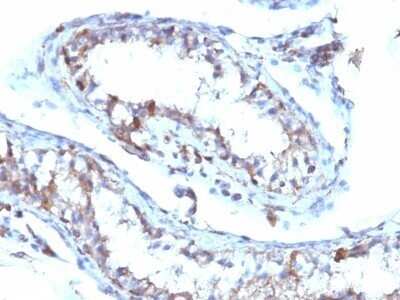 Immunohistochemistry-Paraffin: Moesin Antibody (MSN/493) - Azide and BSA Free [NBP2-47917]