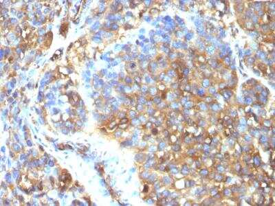Immunohistochemistry-Paraffin: Moesin Antibody (MSN/493) - IHC-Prediluted [NBP2-48306]