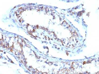 Immunohistochemistry-Paraffin: Moesin Antibody (MSN/493) - IHC-Prediluted [NBP2-48306]