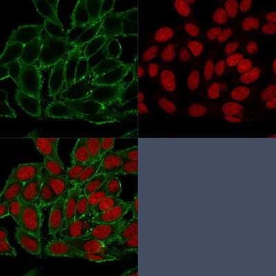 Immunocytochemistry/ Immunofluorescence: Moesin Antibody (MSN/493) [NBP2-44580]