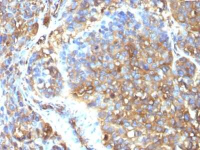 Immunohistochemistry-Paraffin: Moesin Antibody (MSN/493) [NBP2-44580]