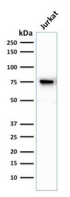 Western Blot: Moesin Antibody (MSN/493) [NBP2-44580]