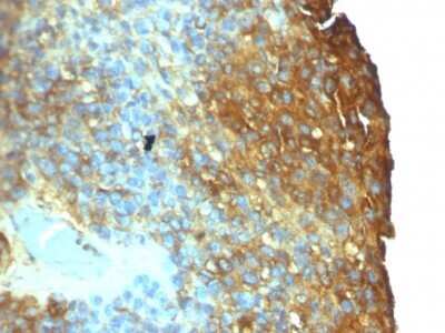 Immunohistochemistry-Paraffin: Moesin Antibody (SPM562) - IHC-Prediluted [NBP2-44578]