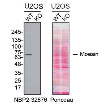 Knockout Validated: Moesin Antibody (SPM562) [NBP2-32876]