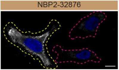 Knockout Validated: Moesin Antibody (SPM562) [NBP2-32876]