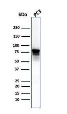 Western Blot: Moesin Antibody (SPM562) [NBP2-32876]