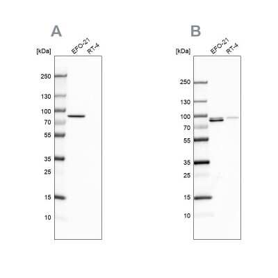 Western Blot: Moesin Antibody [NBP1-90373]