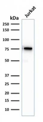 Western Blot: Moesin Antibody (rMSN/492) [NBP3-07218]