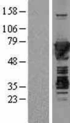 Western Blot: Moesin Overexpression Lysate [NBL1-13334]