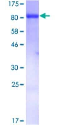 SDS-PAGE: Recombinant Human Moesin GST (N-Term) Protein [H00004478-P01]