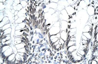 Immunohistochemistry: Mohawk homeobox Antibody [NBP3-10948]