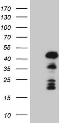 Western Blot: Mohawk homeobox Antibody (OTI6B12)Azide and BSA Free [NBP2-72758]