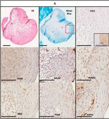 Immunohistochemistry: Mohawk homeobox Antibody (OTI6B12) [NBP2-45863]