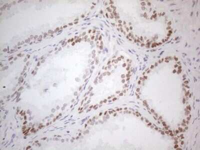 Immunohistochemistry-Paraffin: Mohawk homeobox Antibody (OTI6B12) [NBP2-45863]