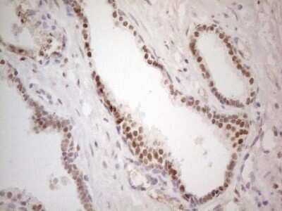 Immunohistochemistry-Paraffin: Mohawk homeobox Antibody (OTI6B12) [NBP2-45863]