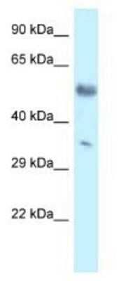 Western Blot: Mohawk homeobox Antibody [NBP1-82408]