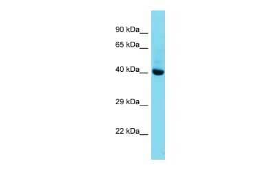 Western Blot: Mohawk homeobox Antibody [NBP3-10446]