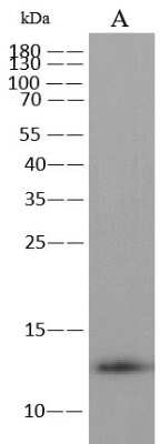 Western Blot: Monkeypox Virus A29 Antibody (0025) [NBP3-18813]