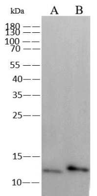 Western Blot: Monkeypox Virus A29 Antibody (0036) [NBP3-18814]