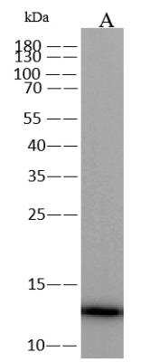 Western Blot: Monkeypox Virus A29L Antibody (0031) [NBP3-18271]