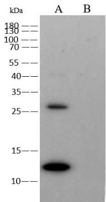 Western Blot: Monkeypox Virus A35 Antibody (0026) [NBP3-18812]