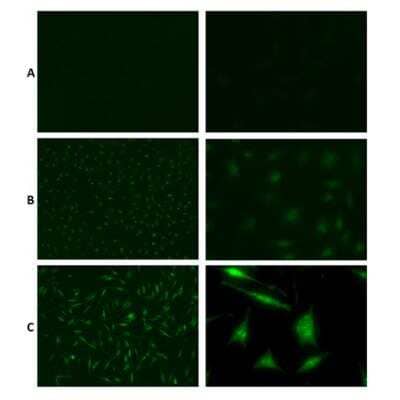 Immunocytochemistry/ Immunofluorescence: Mono- and polyubiquitinylated conjugates Antibody (UBCJ2) [NBP3-06879]