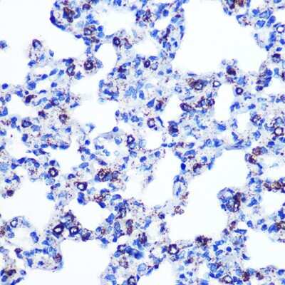 Immunohistochemistry-Paraffin: Monoamine Oxidase B Antibody (5M8A5) [NBP3-15411]