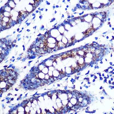 Immunohistochemistry-Paraffin: Monoamine Oxidase B Antibody (5M8A5) [NBP3-15411]
