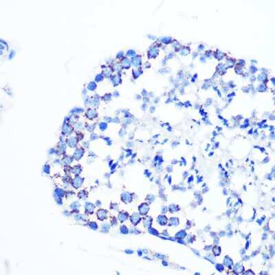 Immunohistochemistry-Paraffin: Monoamine Oxidase B Antibody (5M8A5) [NBP3-15411]
