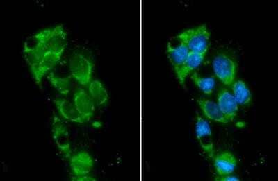 Immunocytochemistry/ Immunofluorescence: Monoamine Oxidase B Antibody [NBP1-32426]