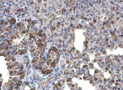 Immunohistochemistry-Paraffin: Monoamine Oxidase B Antibody [NBP1-32426]