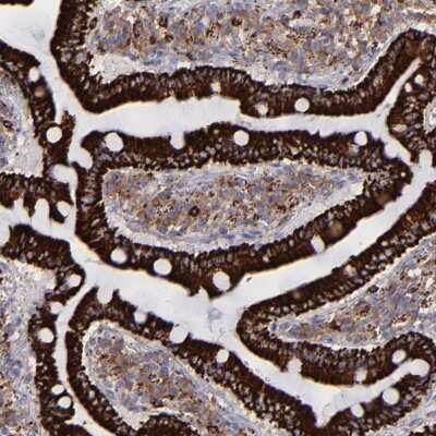 Immunohistochemistry-Paraffin: Monoamine Oxidase B Antibody [NBP1-87493]
