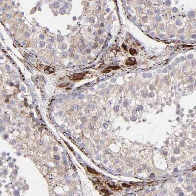 Immunohistochemistry-Paraffin: Monoamine Oxidase B Antibody [NBP1-87493]