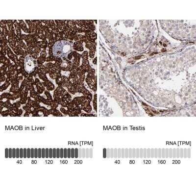 Immunohistochemistry-Paraffin: Monoamine Oxidase B Antibody [NBP1-87493]