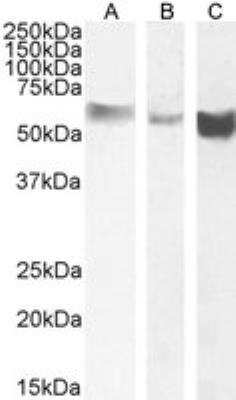 Western Blot: Monoamine Oxidase B Antibody [NB100-2826]