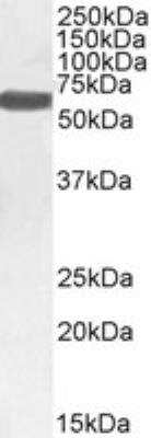 Western Blot: Monoamine Oxidase B Antibody [NB100-2826]