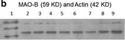 Western Blot: Monoamine Oxidase B Antibody [NBP1-59569]